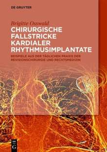 Brigitte Osswald: Chirurgische Fallstricke kardialer Rhythmusimplantate, Buch