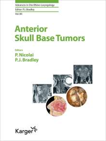 Anterior Skull Base Tumors, Buch