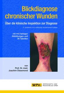 Joachim Dissemond: Blickdiagnose chronischer Wunden, Buch
