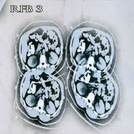 Rich Fabec: Rfb3, CD