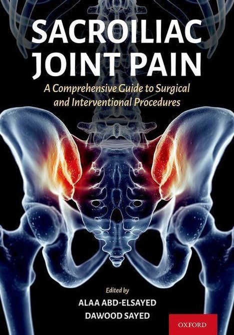 Alaa Abd-Elsayed: Sacroiliac Joint Pain, Buch