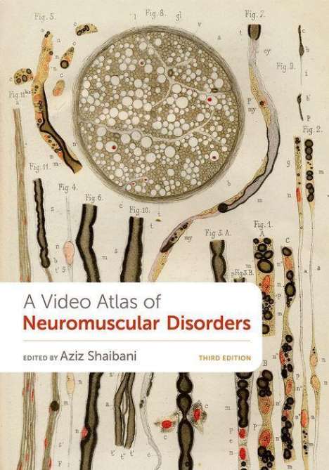 A Video Atlas of Neuromuscular Disorders, Buch