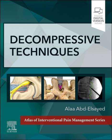 Alaa Abd-Elsayed: Decompressive Techniques, Buch