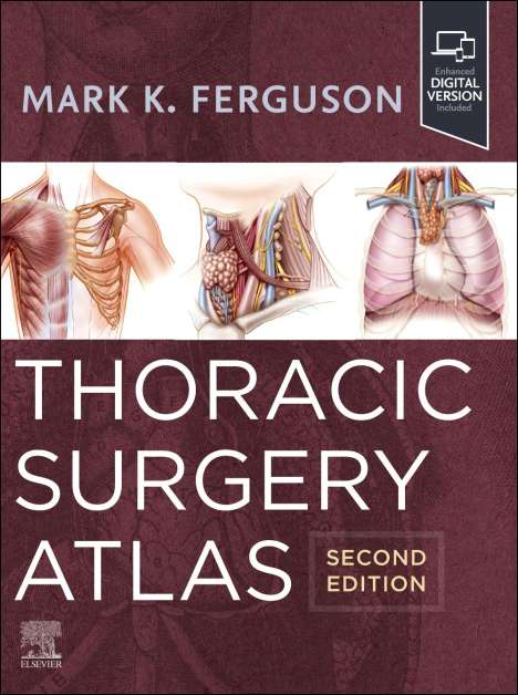 Mark K Ferguson: Thoracic Surgery Atlas, Buch