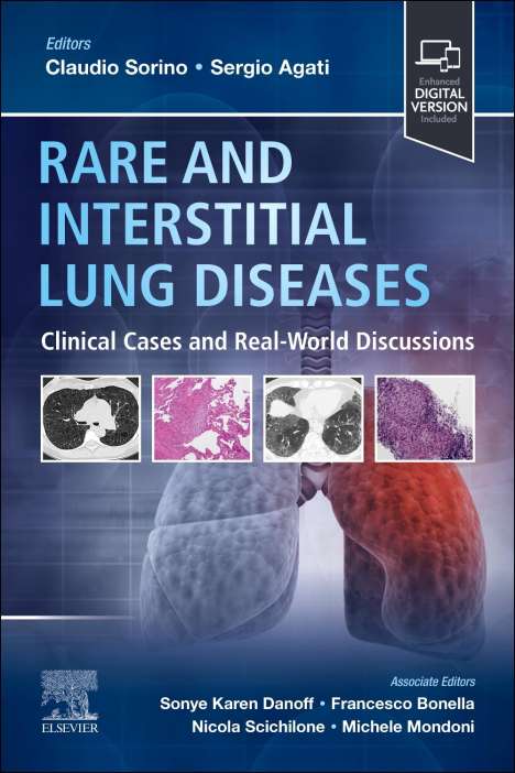 Rare and Interstitial Lung Diseases, Buch