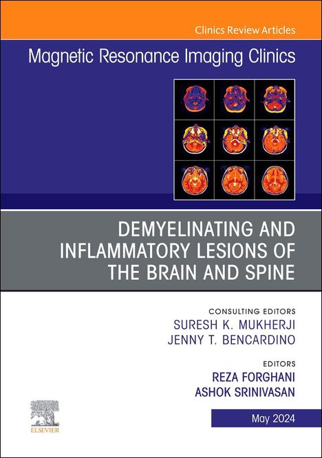 Demyelinating and Inflammatory Lesions of the Brain and Spine, an Issue of Magnetic Resonance Imaging Clinics of North America, Buch