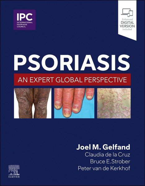 Text: "PSORIASIS: AN EXPERT GLOBAL PERSPECTIVE." Autoren: Joel M. Gelfand, Claudia de la Cruz, Bruce E. Strober, Peter van de Kerkhof. Logo oben links: "IPC International Psoriasis Council." Unten: "Elsevier." Bilder: Haut mit Psoriasis an Beinen, Fingern und Rücken.