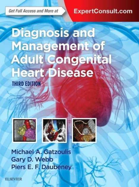 Michael A. Gatzoulis: Diagnosis &amp; Mgmt Of Adult Cong, Buch
