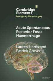 Lauren Harris: Acute Spontaneous Posterior Fossa Haemorrhage, Buch