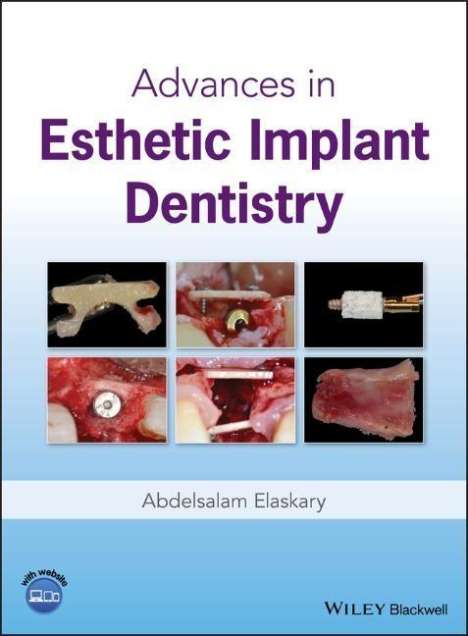 Abdelsalam Elaskary: Advances in Esthetic Implant Dentistry, Buch