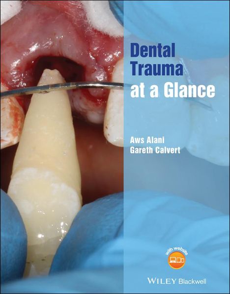 Aws Alani: Dental Trauma at a Glance, Buch