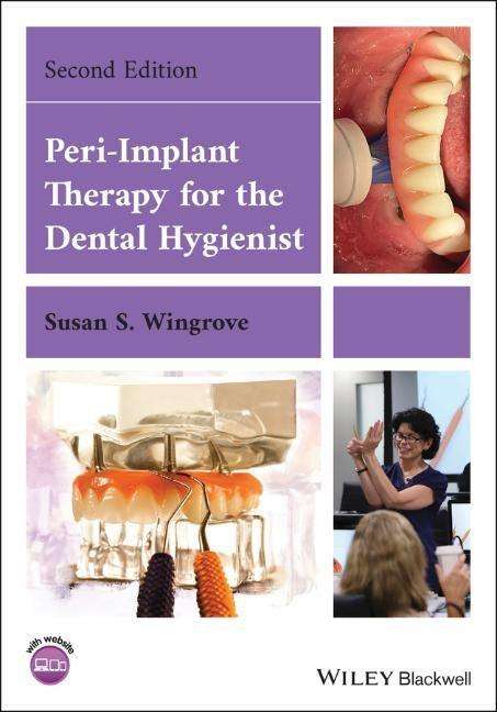Susan S. Wingrove: Peri-Implant Therapy for the Dental Hygienist, Buch