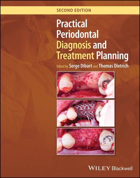 Practical Periodontal Diagnosis and Treatment Planning, Buch