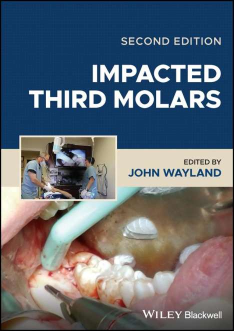 Impacted Third Molars, Buch