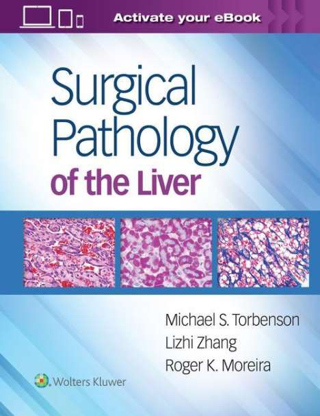 Michael Torbenson: Torbenson, M: Surgical Pathology of the Liver, Buch