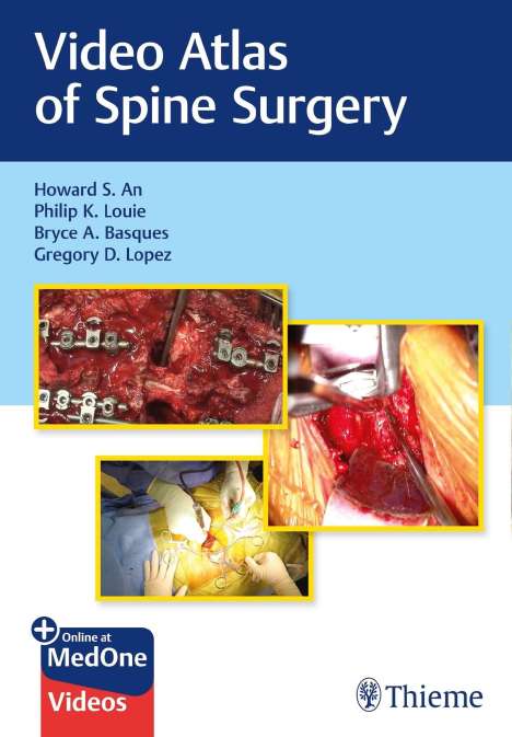 Howard S. An: An, H: Video Atlas of Spine Surgery, Diverse