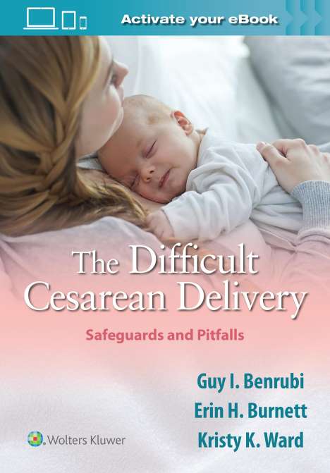 Guy I. Benrubi: Benrubi, G: The Difficult Cesarean Delivery: Safeguards and, Buch