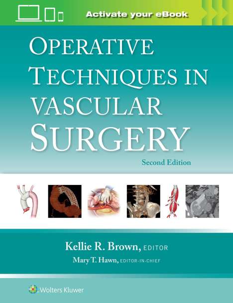 Operative Techniques in Vascular Surgery, Buch