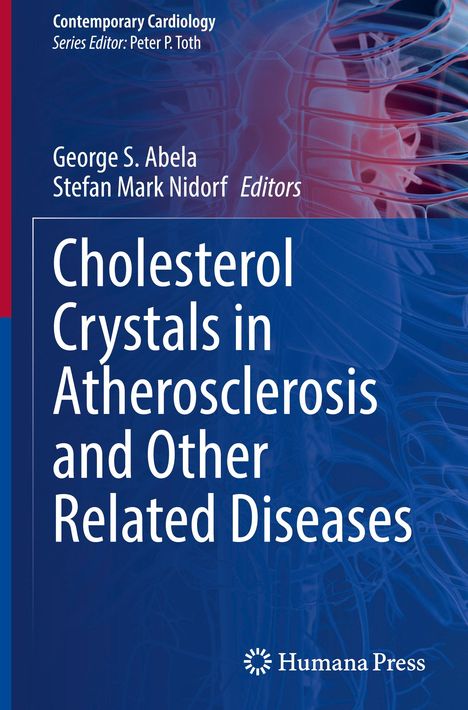Cholesterol Crystals in Atherosclerosis and Other Related Diseases, Buch