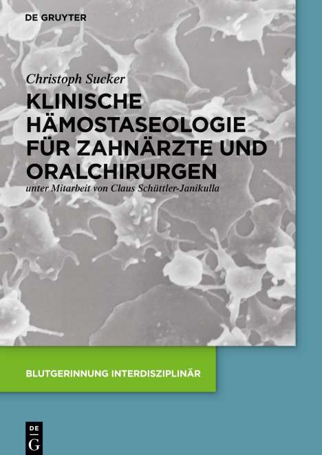 Christoph Sucker: Klinische Hämostaseologie für Zahnärzte und Oralchirurgen, Buch