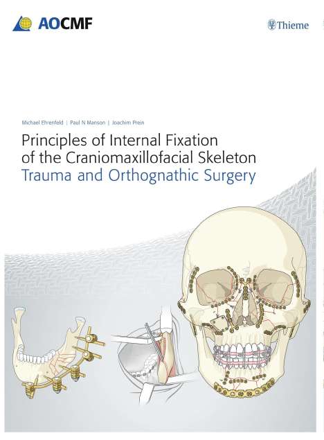 Joachim Prein: Principles of Internal Fixation of the Craniomaxillofacial Skeleton, 1 Buch und 1 Diverse