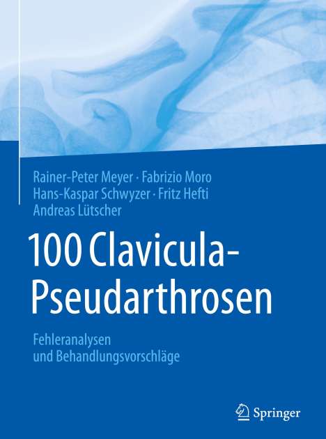 Rainer-Peter Meyer: 100 Clavicula-Pseudarthrosen, Buch