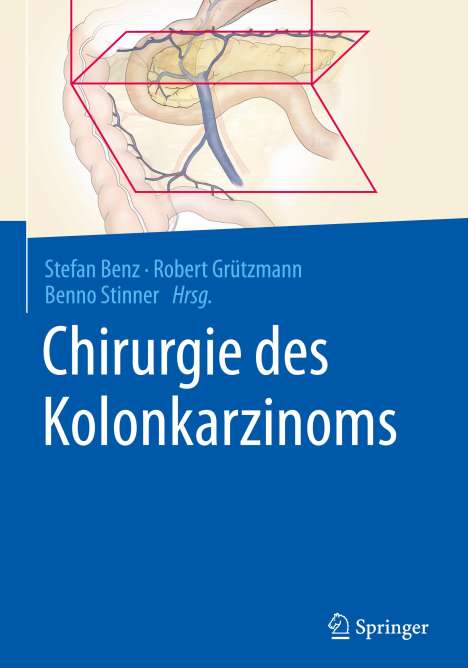 Chirurgie des Kolonkarzinoms, Buch