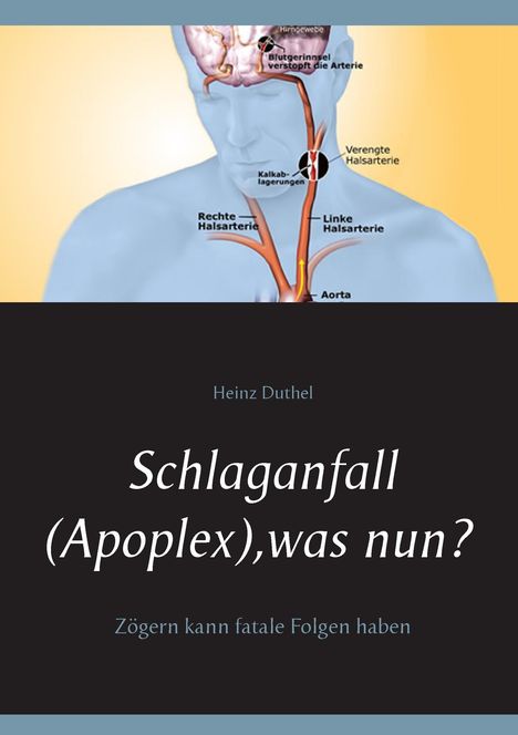 Heinz Duthel: Schlaganfall (Apoplex), was nun?, Buch