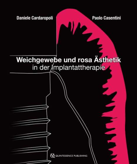 Daniele Cardaropoli: Cardaropoli, D: Weichgewebe und rosa Ästhetik, Buch