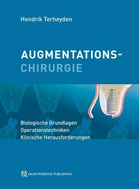 Hendrik Terheyden: Terheyden, H: Augmentationschirurgie, Buch