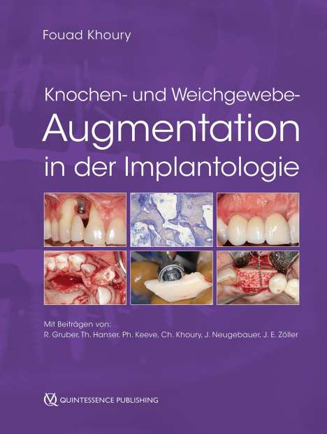 Knochen- und Weichgewebeaugmentation in der Implantologie, Buch