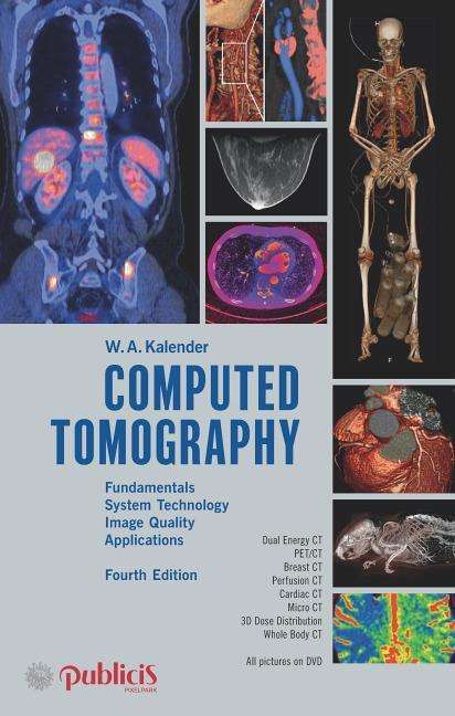 Willi A. Kalender: Kalender, W: Computed Tomography, Buch