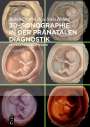 Rabih Chaoui: 3D-Sonographie in der pränatalen Diagnostik, Buch