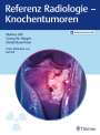 Markus Uhl: Referenz Radiologie - Knochentumoren, Buch,Div.