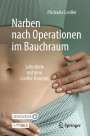 Michaela Liedler: Narben nach Operationen im Bauchraum, Buch