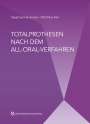 Siegfried Heckmann: Totalprothesen nach dem All-Oral-Verfahren, Buch