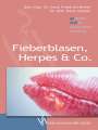Friedrich Breier: Fieberblasen, Herpes & Co, Buch